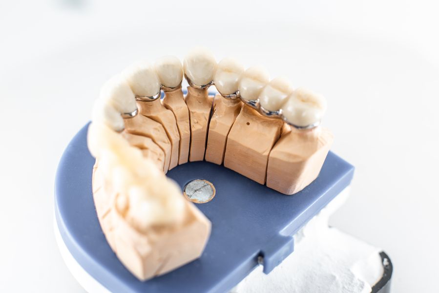 Ile kosztuje sklejenie protezy zębowej