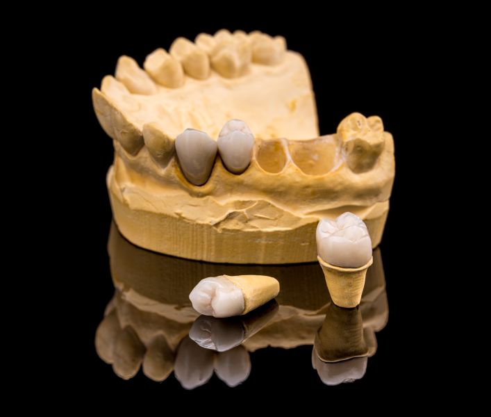 jak usunąć kamień z protezy zębowej